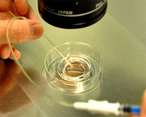 卵巢切除后试管婴儿助孕流程与费用解析