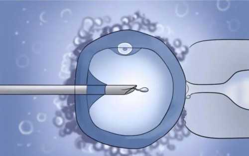 卵巢切除后试管婴儿选择与2026助孕费用详解