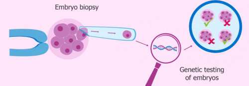天津卵巢切除后试管婴儿助孕指南与费用解析